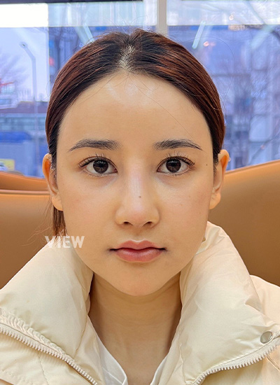  Plastic Surgery in Korea