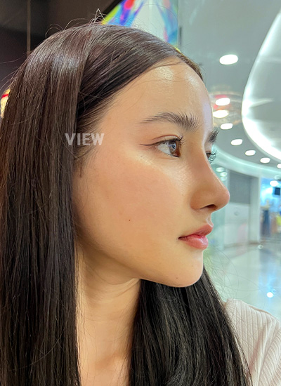 Rhinoplasty & Facial Contouring Plastic Surgery in Korea, Seoul