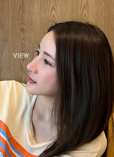 Nose job in Korea Review (View Plastic Surgery)