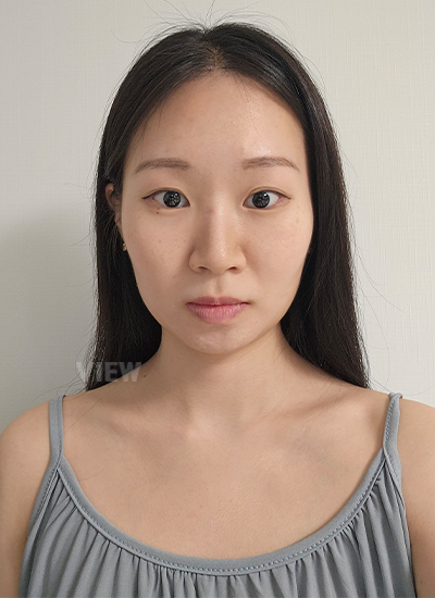 Facial Contouring Surgery, View Plastic Surgery Rhinoplasty Review