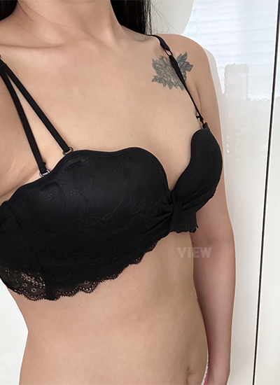 Breast Surgery / Breast Augmentation / Motiva 