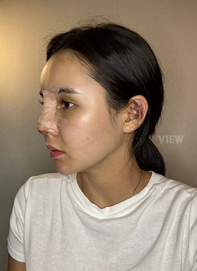 Plastic Surgery in Korea