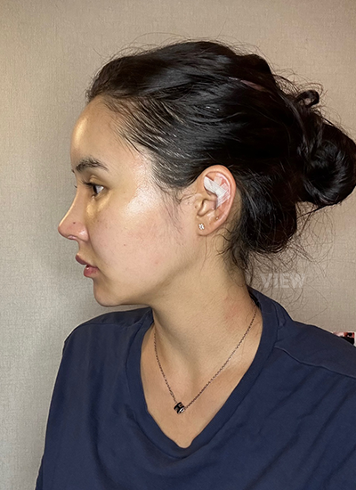 Plastic Surgery in Korea, View Clinic