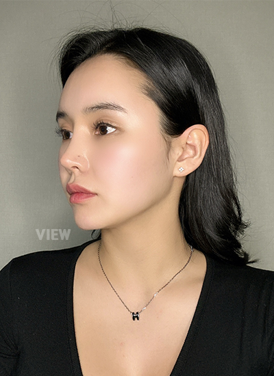 Plastic Surgery in Korea, View Clinic, Korea Clinic