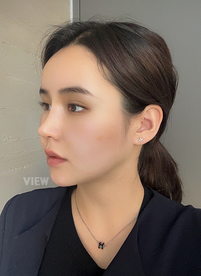 Plastic Surgery in Korea, View Clinic, Korea Clinic