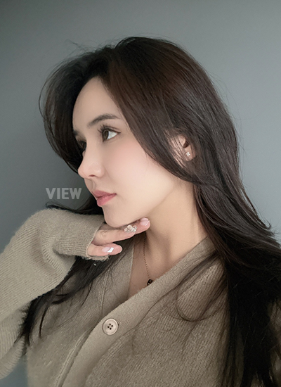 Thread Lift, Fat Grafting, Review at View Plastic Surgery