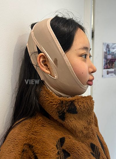 Review at View Plastic Surgery, Plastic Surgery in Korea, View Clinic, Korea Clinic