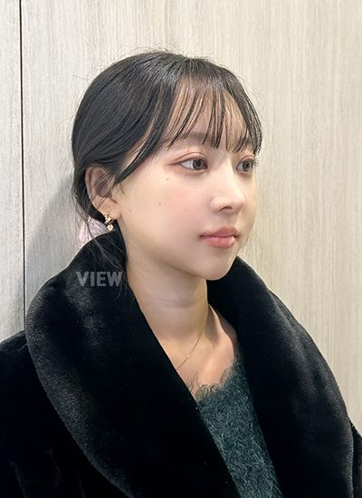 Review at View Plastic Surgery, Plastic Surgery in Korea, View Clinic, Korea Clinic 