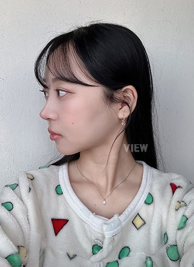 Review at View Plastic Surgery, Plastic Surgery in Korea, View Clinic, Korea Clinic 