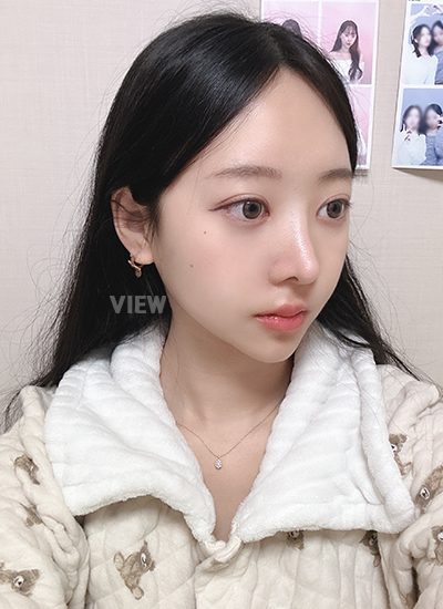 View Plastic Surgery Review, Facial Contouring, Korean Plastic Surgery Clinic Consultation, Cheekbone Reduction Price, Jawline Reduction Price 