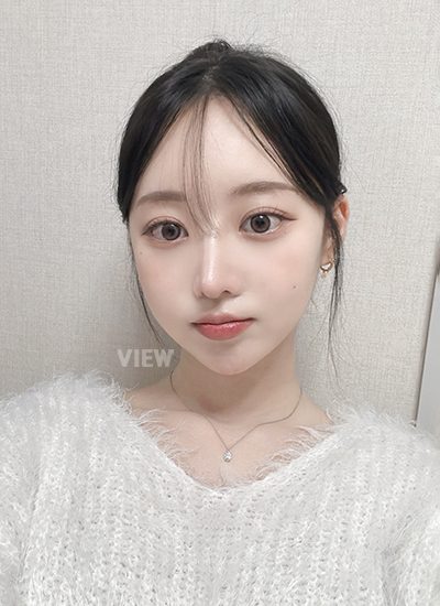 Review at View Plastic Surgery, Plastic Surgery in Korea, View Clinic, Korea Clinic 