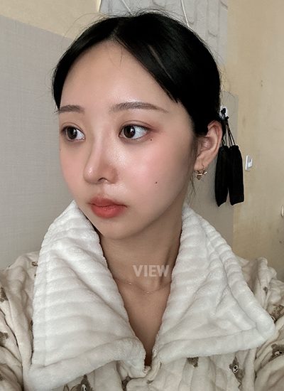 View Plastic Surgery Review, Facial Contouring, Korean Plastic Surgery Clinic Consultation, Cheekbone Reduction Price, Jawline Reduction Price 