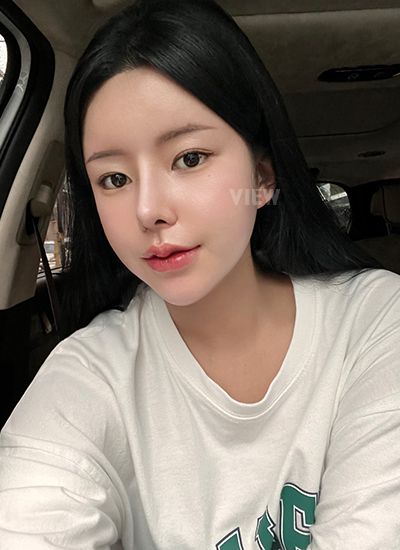 Review at View Plastic Surgery, Plastic Surgery in Korea, View Clinic, Korea Clinic 