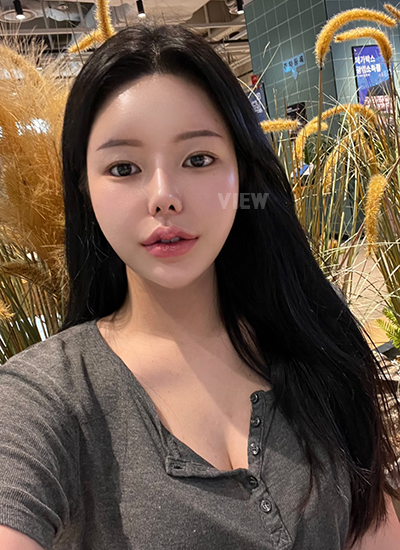 Review at View Plastic Surgery, Plastic Surgery in Korea, View Clinic, Korea Clinic