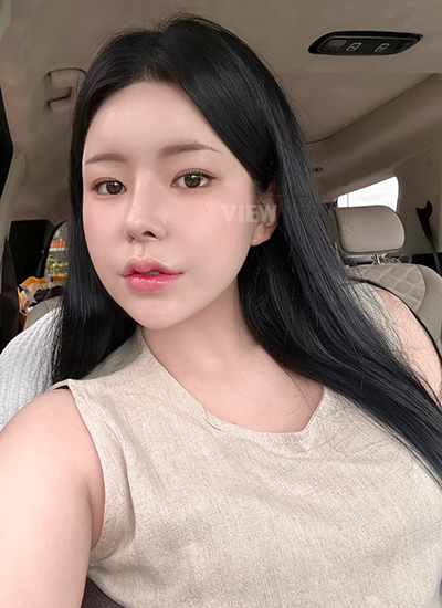 Review at View Plastic Surgery, Plastic Surgery in Korea, View Clinic, Korea Clinic 
