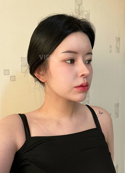 Review at View Plastic Surgery, Plastic Surgery in Korea, View Clinic, Korea Clinic 