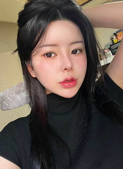 Review at View Plastic Surgery, Plastic Surgery in Korea, View Clinic, Korea Clinic 