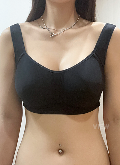 Review at View Plastic Surgery, Plastic Surgery in Korea, View Clinic, Korea Clinic