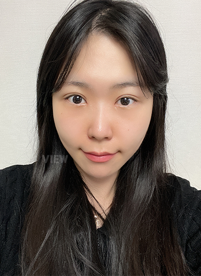 Double eyelid surgery, Non-incisional eyelid surgery 