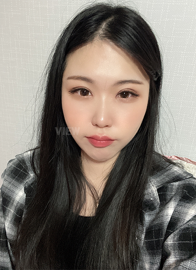 Double eyelid surgery, Non-incisional eyelid surgery 