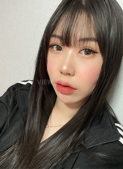 Review at View Plastic Surgery, Plastic Surgery in Korea, View Clinic, Korea Clinic 