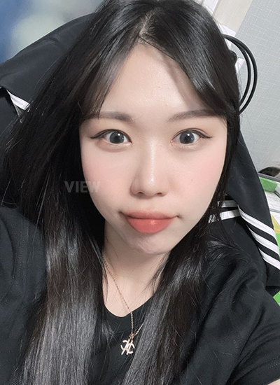 Double eyelid surgery, Non-incisional eyelid surgery 