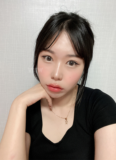 Double eyelid surgery, Non-incisional eyelid surgery 