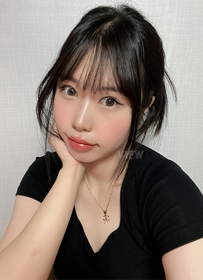 Double eyelid surgery, Non-incisional eyelid surgery 