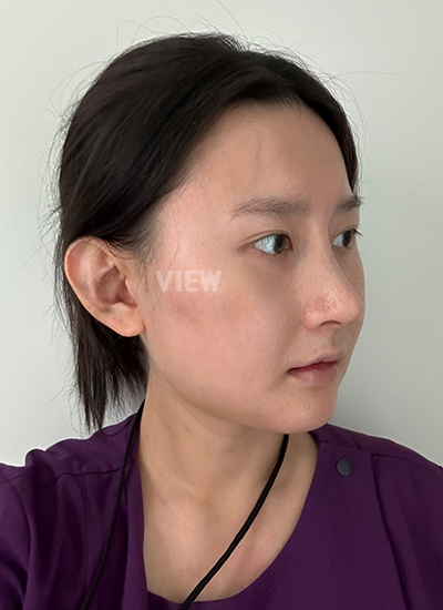 Review at View Plastic Surgery, Plastic Surgery in Korea, View Clinic, Korea Clinic