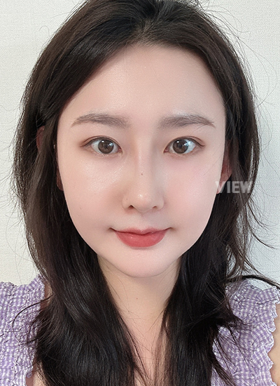 Review at View Plastic Surgery, Plastic Surgery in Korea, View Clinic, Korea Clinic 