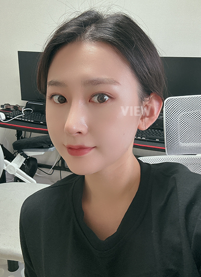 Review at View Plastic Surgery, Plastic Surgery in Korea, View Clinic, Korea Clinic 