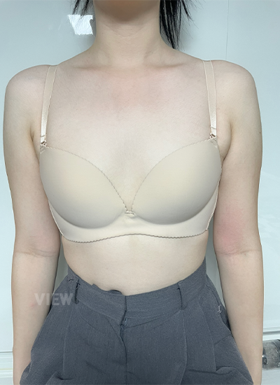 Review at View Plastic Surgery, Plastic Surgery in Korea, View Clinic, Korea Clinic 