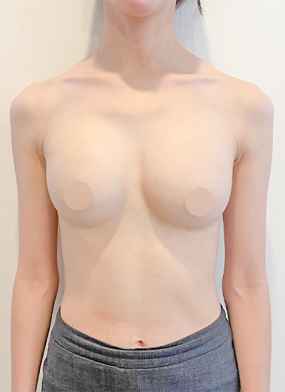 Review at View Plastic Surgery, Plastic Surgery in Korea, View Clinic, Korea Clinic 