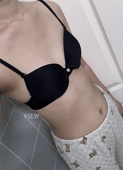 Review at View Plastic Surgery, Plastic Surgery in Korea, View Clinic, Korea Clinic 