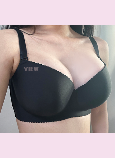 Breast Augmentation, Breast Enlargement Surgery, Breast surgery, Breast augmentation surgery, Mentor review, Breast surgery clinic, Mentor implants, Mentor Xtra Smooth, Breast implants 