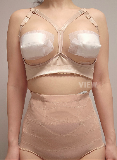 Breast Augmentation, Breast Enlargement Surgery, Breast surgery, Breast augmentation surgery, Mentor review, Breast surgery clinic, Mentor implants, Mentor Xtra Smooth, Breast implants 