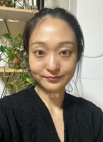 Review at View Plastic Surgery, Plastic Surgery in Korea, View Clinic, Korea Clinic 