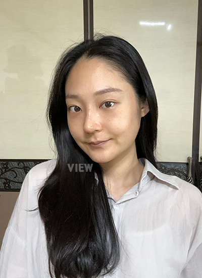 Rhinoplasty, Nose Job 