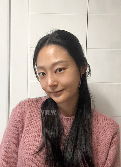 Review at View Plastic Surgery, Plastic Surgery in Korea, View Clinic, Korea Clinic 