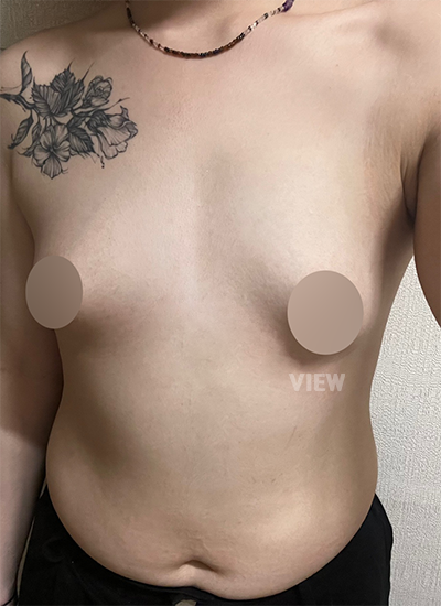 Review at View Plastic Surgery, Plastic Surgery in Korea, View Clinic, Korea Clinic 