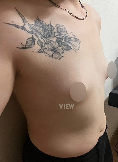 Review at View Plastic Surgery, Plastic Surgery in Korea, View Clinic, Korea Clinic 