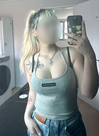 Review at View Plastic Surgery, Plastic Surgery in Korea, View Clinic, Korea Clinic 