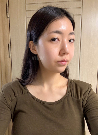 Review at View Plastic Surgery, Plastic Surgery in Korea, View Clinic, Korea Clinic