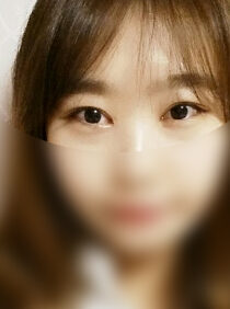 [Eye correction + cataract] Hyejin Yang