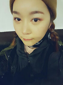 [Natural V line + cheekbone reduction + forehead implant + nose surgery] Jinah Yoon