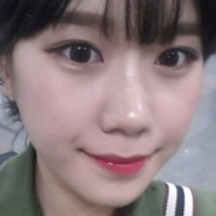 [Natural V line + cheekbone reduction + forehead implant] Dahye Kim