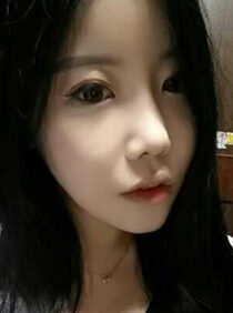 [Natural V-line + cheekbone reduction + rhinoplasty + eye surgery + forehead implant + noble surgery] Lee Joo-yeon