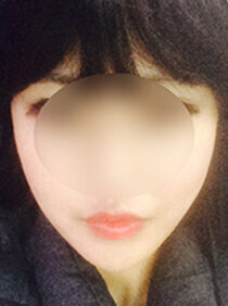 [Doll Line + Square Jaw Reduction + Front Jaw Surgery] Yunhee Kim
