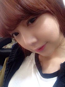 [Natural V line + cheekbone reduction + noble plastic surgery + non-incision eyelid correction + nose surgery] Park Eun-bi