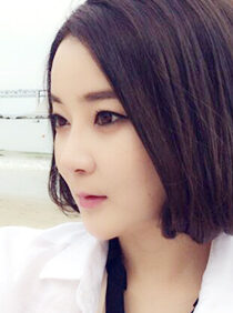 [Natural V-line + eyelid correction + noble surgery] Eunkyung Lee